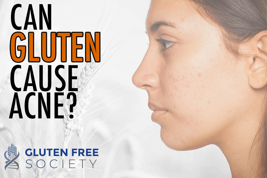 gluten sensitivity and acne
